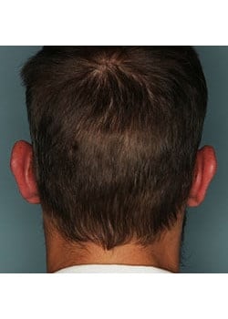 After Image