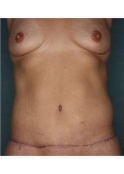 After Image